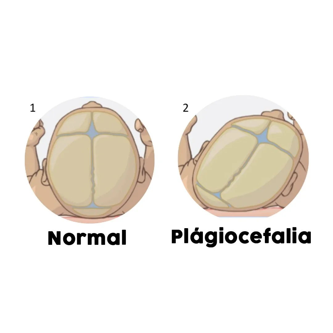 Como evitar que a cabeça do bebê fique torta