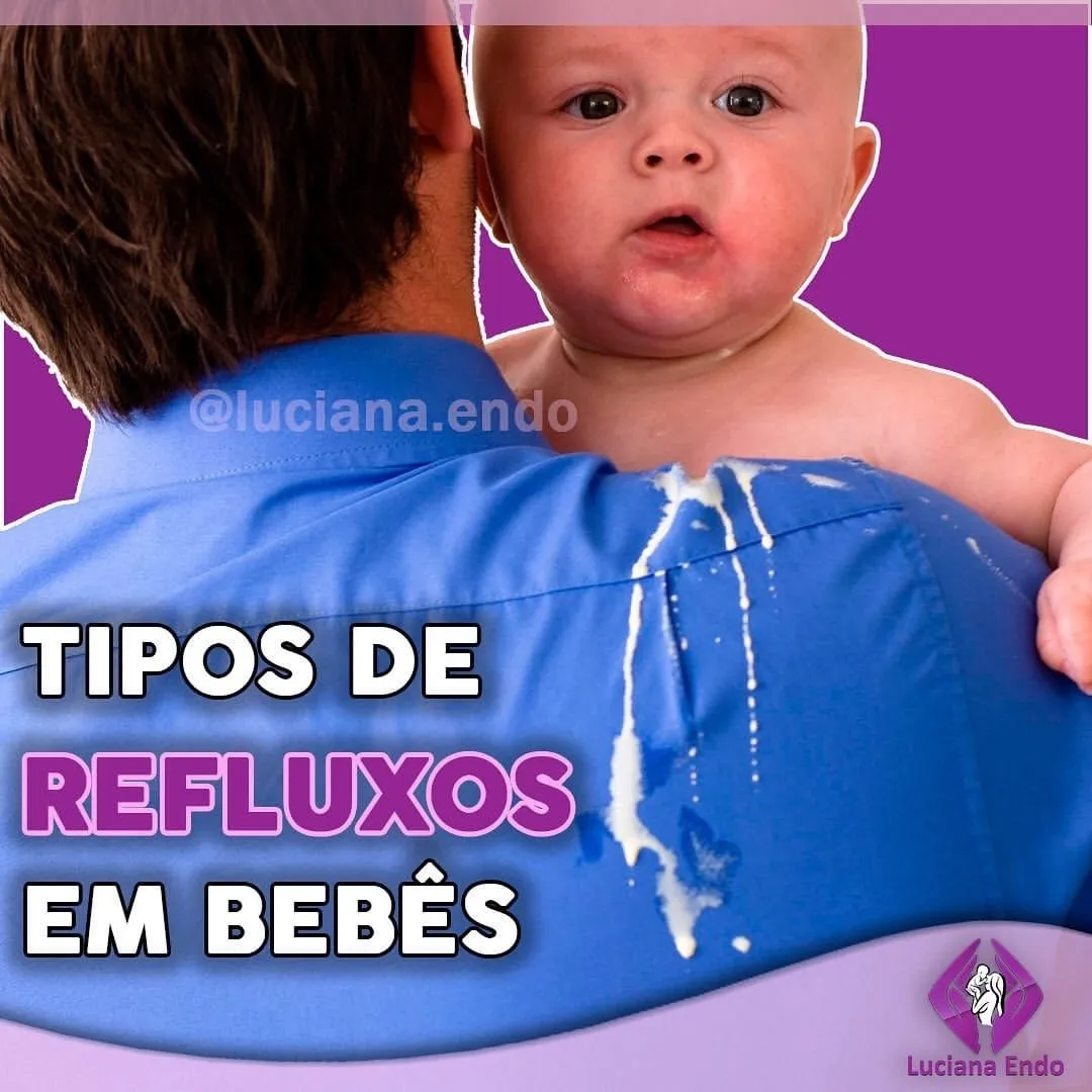 Refluxo gastroesofágico: tipos, sinais e sintomas que seu bebê pode apresentar